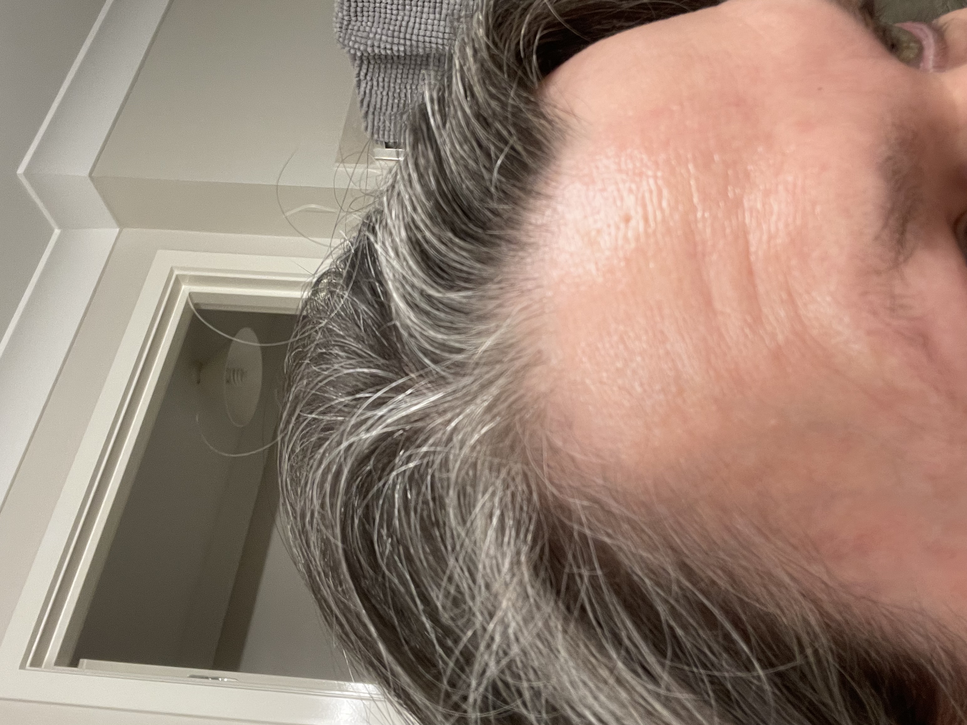 ザセム　SYN-AKE SENSITIVE MULTY SERUM 5本セット ザセム SYN-AKE SENSITIVE MULTY SERUM 5本セット - メルカリ