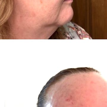 GHK-CU Crepey Skin Escape - Platinum Skin Care GHK-CU Crepey Skin Escape - Platinum Skin Care